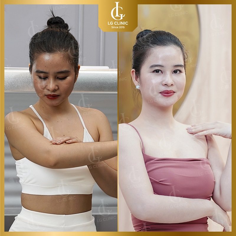 Địa chỉ tắm trắng tốt nhất Sài Gòn