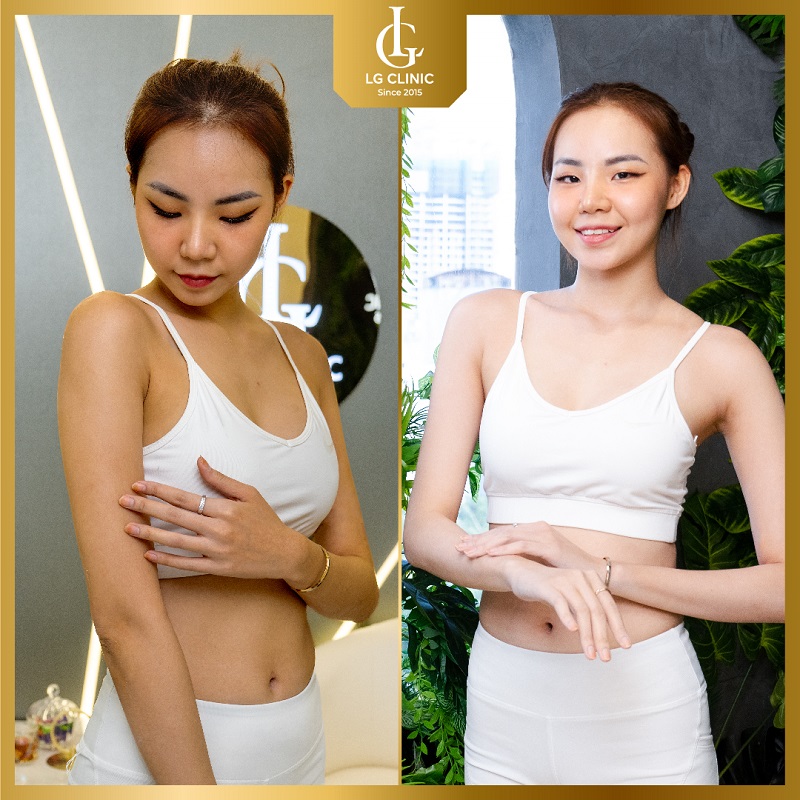 Địa chỉ tắm trắng
