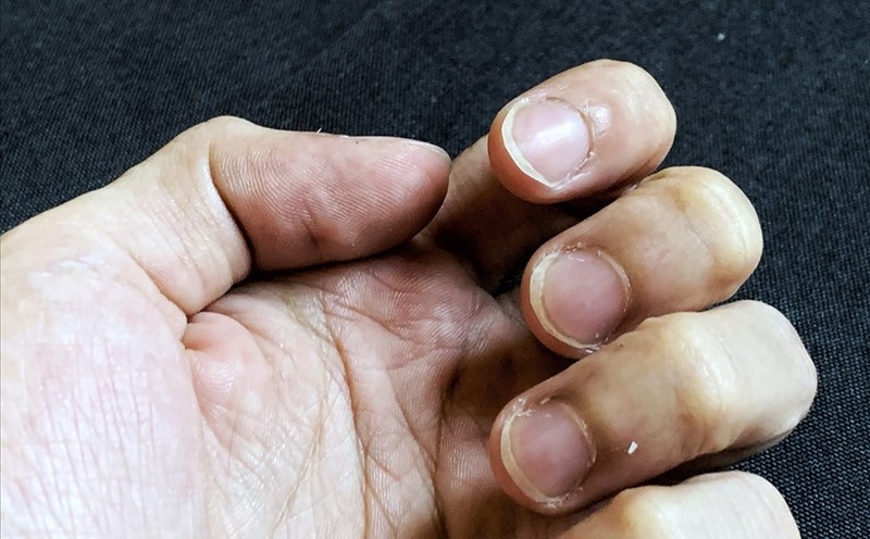 tại sao da tay bị khô