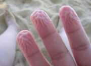 Lý do da tay dễ bị nhăn khi gặp nước?