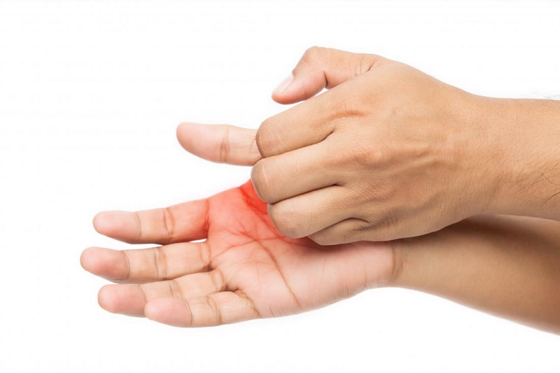 da tay tự nhiên nóng rát