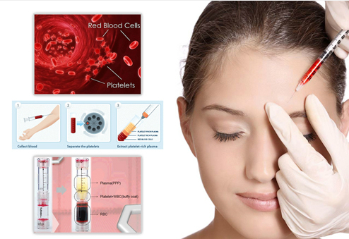 phương pháp làm đẹp prp