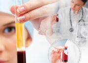 Những điều cần biết về phương pháp làm đẹp PRP