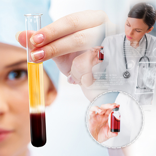 làm đẹp da bằng phương pháp prp