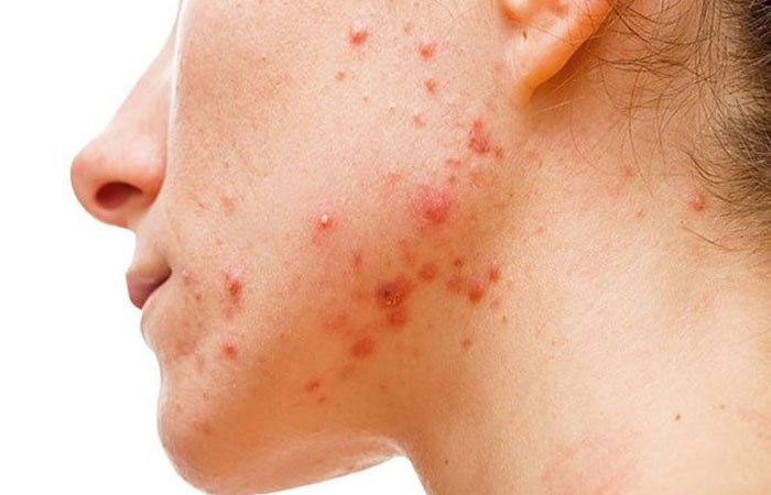 dưa leo có tác dụng gì cho da mặt