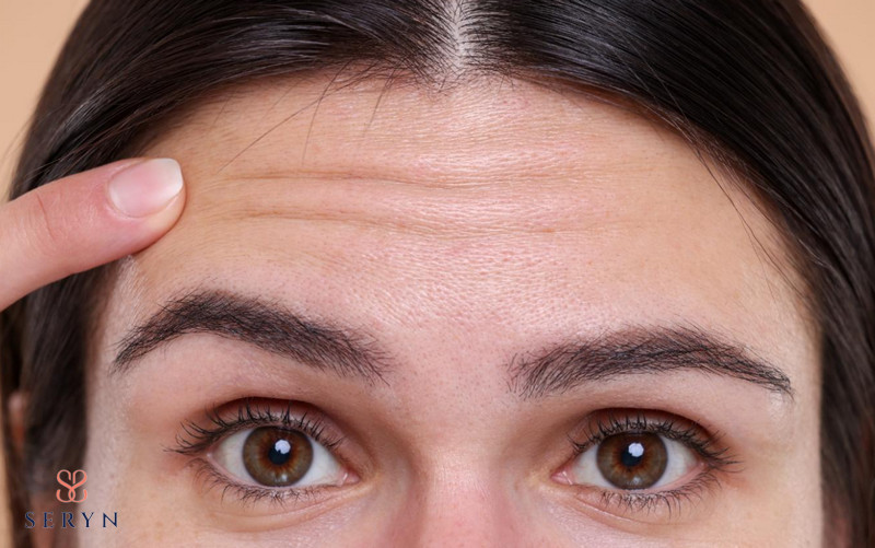 cách xóa nếp nhăn vùng trán